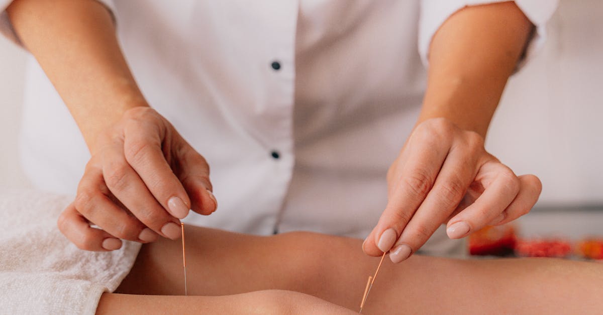 Benefits of Incorporating Electro-Acupuncture into Your Treatment Plan
