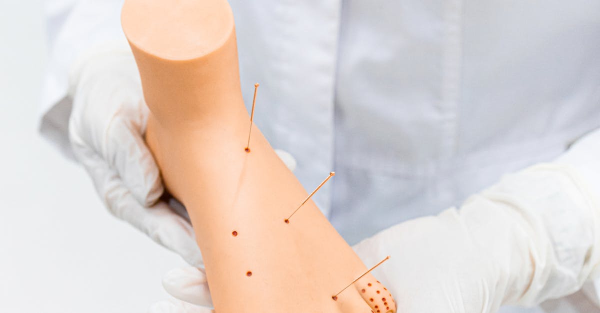 Exploring the Benefits of Acupuncture for Sports Injuries
