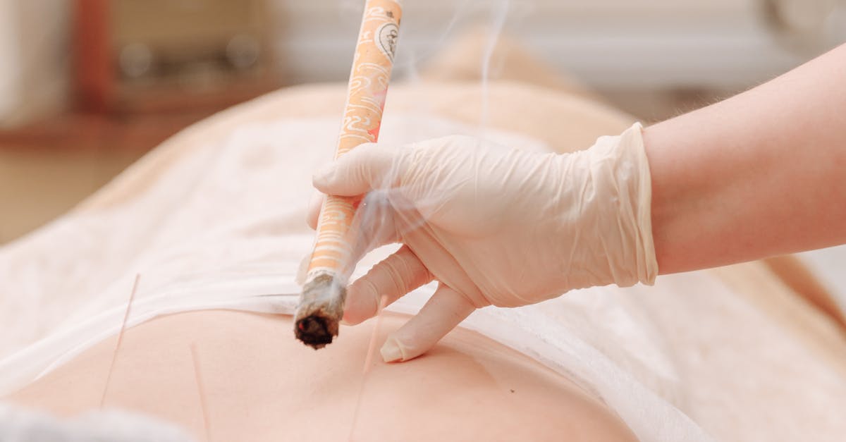 Exploring the Link Between Acupuncture and Immune Health