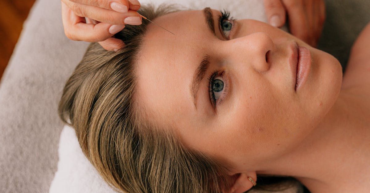 Real Stories: Stress Reduction Success Through Acupuncture