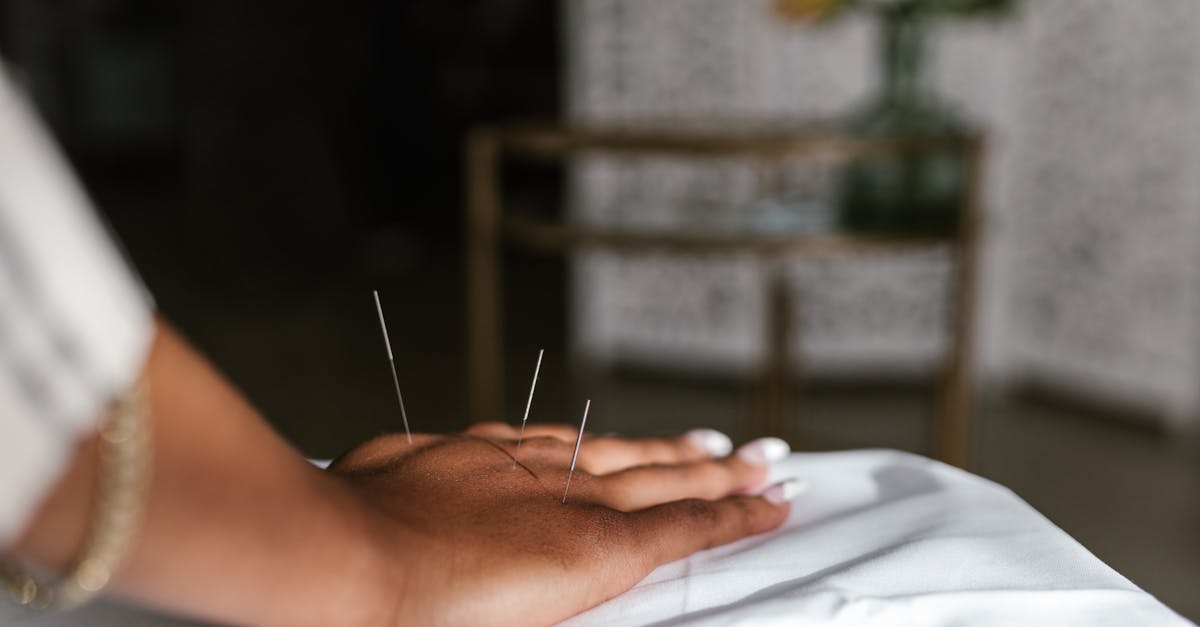 Top Rated Acupuncture Clinics in Melbourne: What Patients Are Saying
